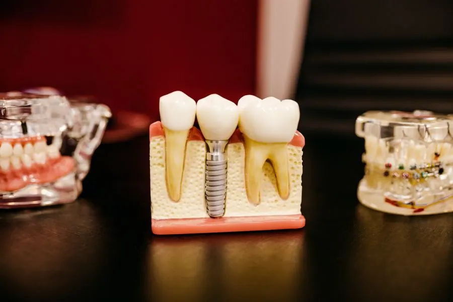 5 công việc của một kỹ thuật viên phục hình răng không phải ai cũng biết 3