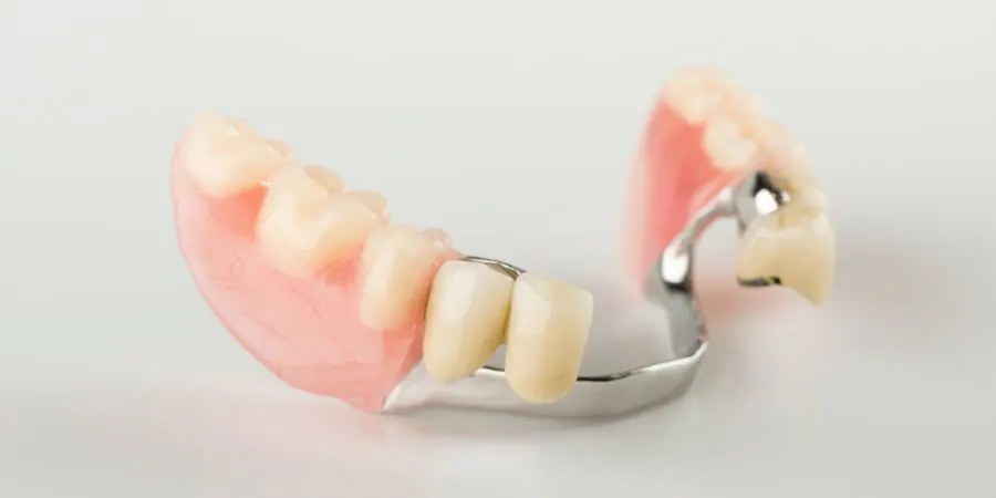 Những loại phục hình răng phổ biến trong nha khoa thẩm mỹ mà các kỹ thuật viên phục hình răng nên biết 3