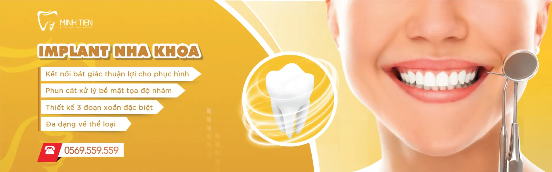 Implant nha khoa Minh Tiến