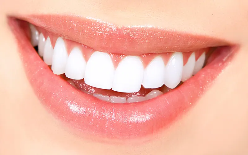 Răng Sứ HT Smile Là Gì? Những Ưu Điểm Vượt Trội Của Răng Sứ HT Smile - ảnh 4